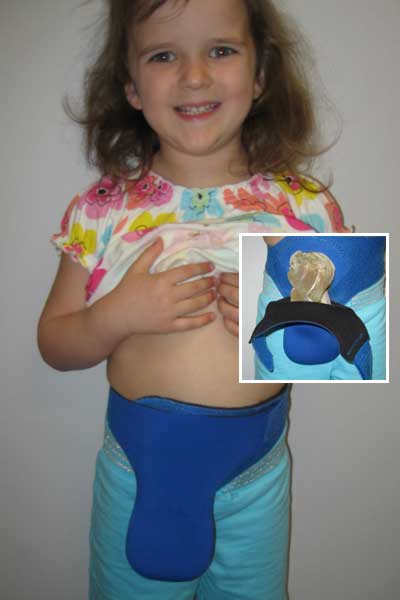 Ostomy Belt and Collection Pouch