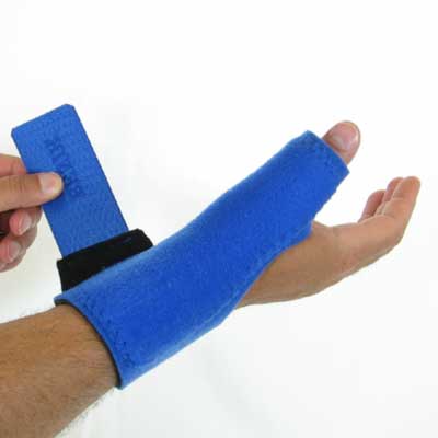 W-205 Thumb Splint Radial View