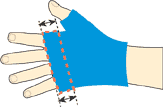 Proximal Length