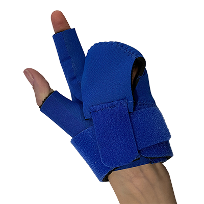 Finger Flexion Flap - Volar