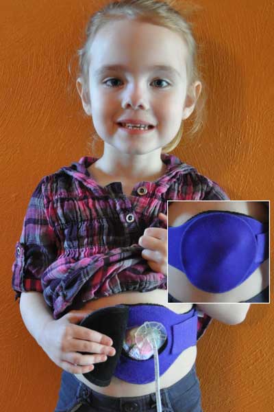 Pediatric G Tube Protective Belt JA 10G Benik Corp. Benik Corp